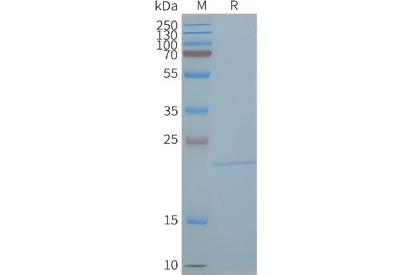 Claudin 5 Protein (CLDN5)