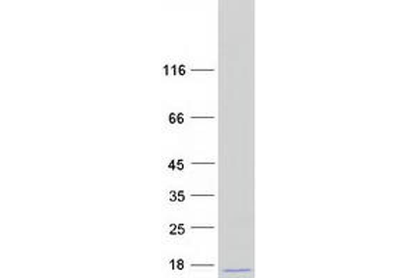 FAU Protein (Myc-DYKDDDDK Tag)