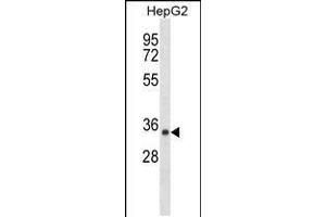 Western blot analysis in HepG2 cell line lysates (35ug/lane). (SDR39U1 抗体  (N-Term))