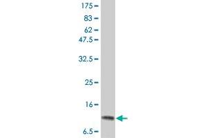 Western Blot detection against Immunogen (15. (IL-2 抗体  (AA 21-153))