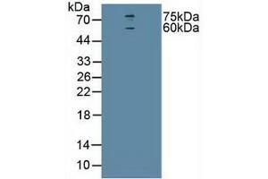 Detection of CHRNa4 in Human U-87MG Cells using Polyclonal Antibody to Cholinergic Receptor, Nicotinic, Alpha 4 (CHRNa4) (CHRNA4 抗体  (AA 49-242))