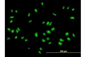 Immunofluorescence of purified MaxPab antibody to RSL1D1 on HeLa cell. (RSL1D1 抗体  (AA 1-490))