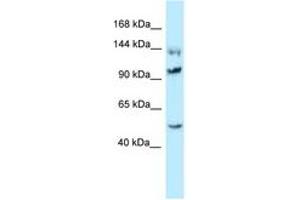 Image no. 1 for anti-Heat Shock 105kDa/110kDa Protein 1 (HSPH1) (C-Term) antibody (ABIN6747876) (HSPH1 抗体  (C-Term))