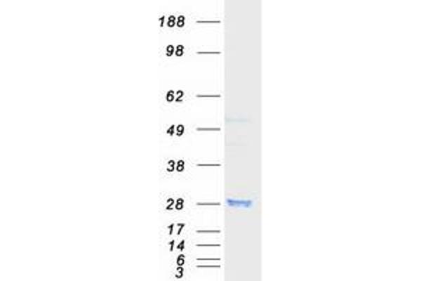 RAB8A Protein (Myc-DYKDDDDK Tag)