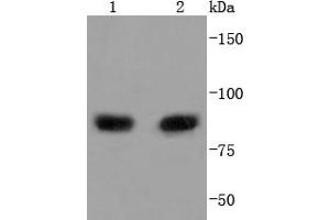 Lane 1: MCF-7, Lane 2: Raji lysate probed with PI 3 Kinase p85 alpha (2G4) Monoclonal Antibody  at 1:1000 overnight at 4˚C. (PIK3R1 抗体)