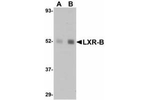 Image no. 1 for anti-Nuclear Receptor Subfamily 1, Group H, Member 2 (NR1H2) (N-Term) antibody (ABIN478107) (NR1H2 抗体  (N-Term))