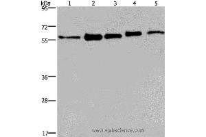 Western blot analysis of MCF-7, 293T, A549, Hela and HepG2 cell, using HNRNPL Polyclonal Antibody at dilution of 1:450 (HNRNPL 抗体)