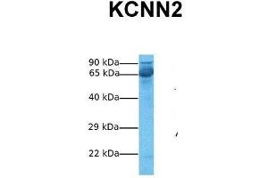 Host:  Rabbit  Target Name:  KCNN2  Sample Tissue:  Human Fetal Liver  Antibody Dilution:  1. (KCNN2 抗体  (C-Term))