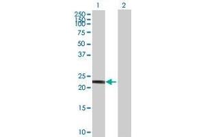 Lane 1: DGCR6 transfected lysate ( 24. (DGCR6 293T Cell Transient Overexpression Lysate(Denatured))