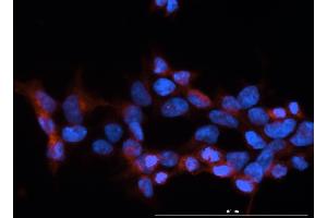 Immunofluorescence (IF) image for anti-neonatal Fc Receptor (FcRn) antibody (ABIN1774762)