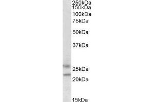 ABIN2562562 (1. (FBXO44 抗体  (C-Term))