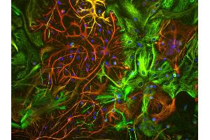 View of mixed neuron/glial cultures stained with Vimentin antibody (green) our our rabbit antibody to GFAP antibody (RPCA-GFAP, red). (Vimentin 抗体)