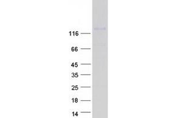 ITGA3 Protein (Transcript Variant B) (Myc-DYKDDDDK Tag)