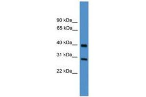 Image no. 1 for anti-Metalloproteinase Inhibitor 2 (TIMP2) (AA 130-179) antibody (ABIN6745438) (TIMP2 抗体  (AA 130-179))
