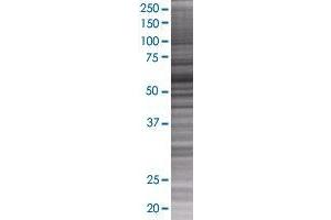 PAMCI transfected lysate. (PAMCI 293T Cell Transient Overexpression Lysate(Denatured))