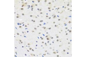 Immunohistochemistry of paraffin-embedded mouse brain using SAFB2 antibody. (SAFB2 抗体)