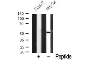 Western blot analysis of NDR1/2 in lysates of HepG2? (NDR1/2 抗体)