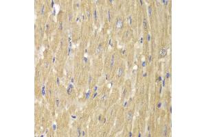 Immunohistochemistry of paraffin-embedded mouse heart using NCF2 antibody (ABIN5970524) at dilution of 1/100 (40x lens). (NCF2 抗体)