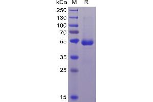 Human CD70 Protein, mFc-His Tag on SDS-PAGE under reducing condition. (CD70 Protein (mFc-His Tag))