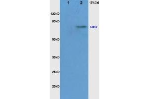 Lane 1: Mouse Liver, lysates Lane 2: Mouse Brain probed with Rabbit Anti-c-Raf(Ser338/Tyr340) Polyclonal Antibody, Unconjugated  at 1:200 overnight at 4˚C. (RAF1 抗体  (pSer338, pTyr340))