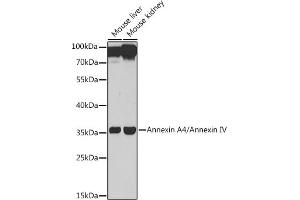 Western blot analysis of extracts of various cell lines, using Annexin /Annexin IV antibody (ABIN6127353, ABIN6136931, ABIN6136933 and ABIN6217476) at 1:1000 dilution. (Annexin IV 抗体  (AA 112-321))