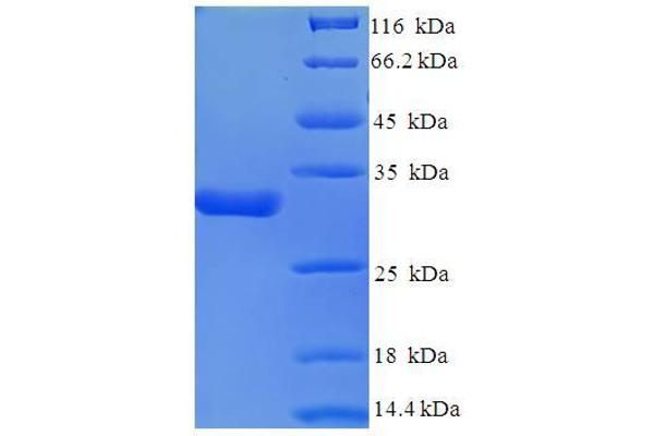 CACNA2D1 Protein (AA 528-668, partial) (His-SUMO Tag)