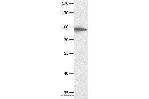 Western blot analysis of Hela cell, using HCN1 Polyclonal Antibody at dilution of 1:950 (HCN1 抗体)