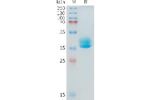 ADAM17 Protein (AA 581-642) (mFc Tag)