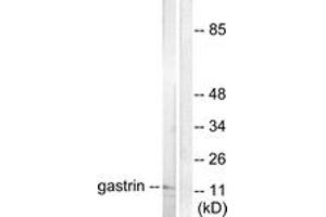 Western blot analysis of extracts from NIH-3T3 cells, using Gastrin Antibody. (Gastrin 抗体  (AA 52-101))