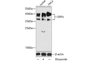 Western blot analysis of extracts of various cell lines, using DFFA antibody (ABIN6127756, ABIN6139549, ABIN6139551 and ABIN6216052) at 1:1000 dilution. (DFFA 抗体  (AA 1-331))