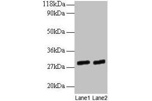 Western blot All lanes: GATD3A antibody at 2 μg/mL Lane 1: EC109 whole cell lysate Lane 2: 293T whole cell lysate Secondary Goat polyclonal to rabbit IgG at 1/15000 dilution Predicted band size: 29, 25 kDa Observed band size: 29 kDa (GATD3A (AA 43-268) 抗体)