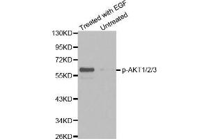 Western blot analysis of extracts from HepG2 cells untreated or treated with EGF using Phospho-AKT1/2/3-Y315/316/312 antibody (AKT 1/2/3 抗体  (pTyr312))