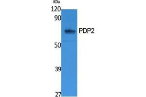 Western Blotting (WB) image for anti-Pyruvate Dehyrogenase Phosphatase Catalytic Subunit 2 (PDP2) (Internal Region) antibody (ABIN3178105) (PDP2 抗体  (Internal Region))