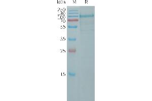 Human Protein, His Tag on SDS-PAGE under reducing condition. (CDH10 Protein (AA 55-613) (His tag))