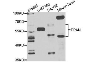 Western blot analysis of extracts of various cell lines, using PPAN antibody. (PPAN 抗体)