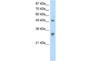 DDX19B antibody used at 2. (DDX19B 抗体)