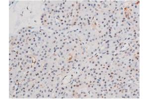 ABIN6267555 at 1/200 staining Human pancreas tissue sections by IHC-P. (LIMK2 抗体  (pSer283))