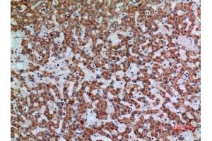 Immunohistochemical analysis of paraffin-embedded human-liver, antibody was diluted at 1:100. (APAF1 抗体  (Internal Region))