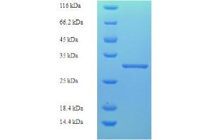 SDS-PAGE (SDS) image for Kallikrein 7 (KLK7) (AA 25-261) protein (His tag) (ABIN5709813) (Kallikrein 7 Protein (KLK7) (AA 25-261) (His tag))