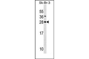 Western blot analysis of SDC4 Antibody (Center) Cat. (SDC4 抗体  (Middle Region))