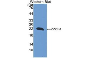 Detection of Recombinant PARK7, Rat using Monoclonal Antibody to Parkinson Disease Protein 7 (PARK7) (PARK7/DJ1 抗体  (AA 1-189))
