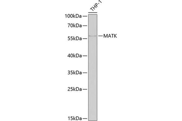 MATK 抗体  (AA 352-466)