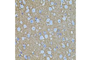 Immunohistochemistry of paraffin-embedded mouse brain using STX1A antibody (ABIN6134937, ABIN6148660, ABIN6148662 and ABIN6223930) (40x lens). (STX1A 抗体)