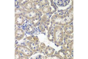 Immunohistochemistry of paraffin-embedded rat kidney using H6PD antibody (ABIN5973840) at dilution of 1/200 (40x lens). (Glucose-6-Phosphate Dehydrogenase 抗体)