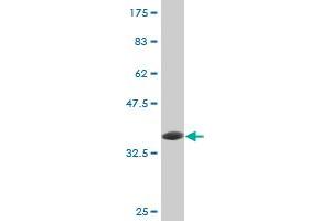 Western Blot detection against Immunogen (36. (ube3a 抗体  (AA 51-150))