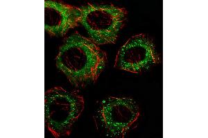 Fluorescent image of A549 cell stained with FADS2 Antibody (N-term). (FADS2 抗体  (N-Term))