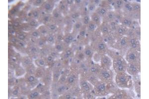 DAB staining on IHC-P; Samples: Mouse Liver Tissue (ACAA1 抗体  (AA 182-424))