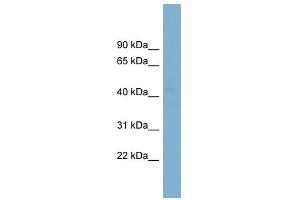 PCYT2 antibody used at 1 ug/ml to detect target protein. (PCYT2 抗体  (Middle Region))