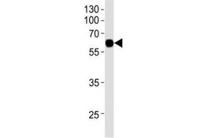 Western blot analysis of recombinant protein using KLF4 antibody at 1:1000. (KLF4 抗体)