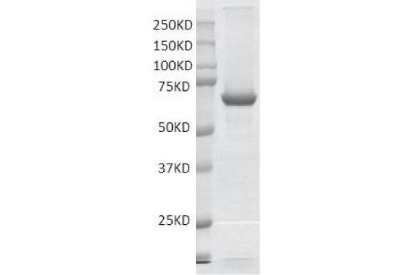 PRMT3 Protein (DYKDDDDK Tag)